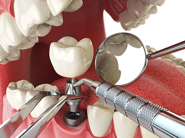 Best Emergency Tooth Extraction in Reynoldsville, PA